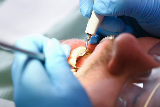 Best Emergency Dental Care for Sports Injuries in Goodhue, MN
